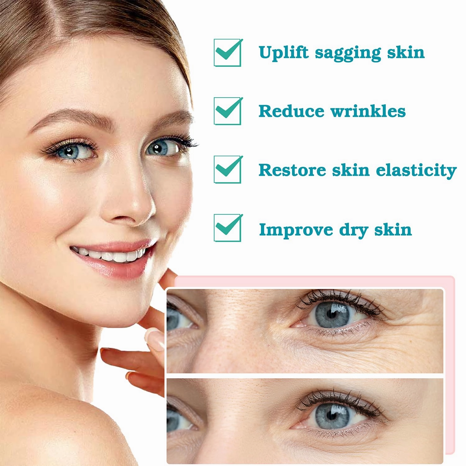 Pdo Threads for Face Lift Mono Screw Type (30g38MM) Smoothing Wrinkles PDO Thread Lift for Whole Body with Sharp Tip 20pcs