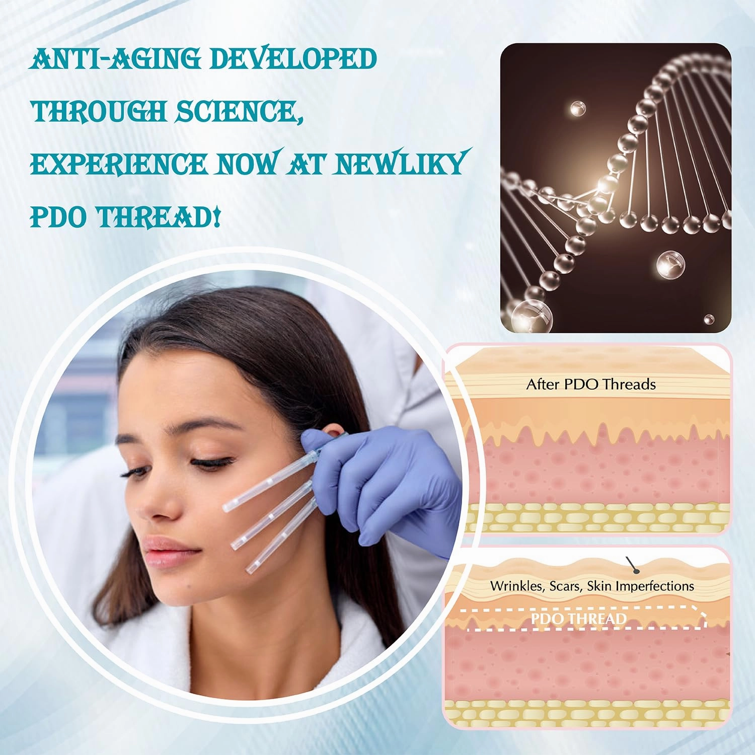 Pdo Threads for Face Lift Mono Screw Type (30g38MM) Smoothing Wrinkles PDO Thread Lift for Whole Body with Sharp Tip 20pcs