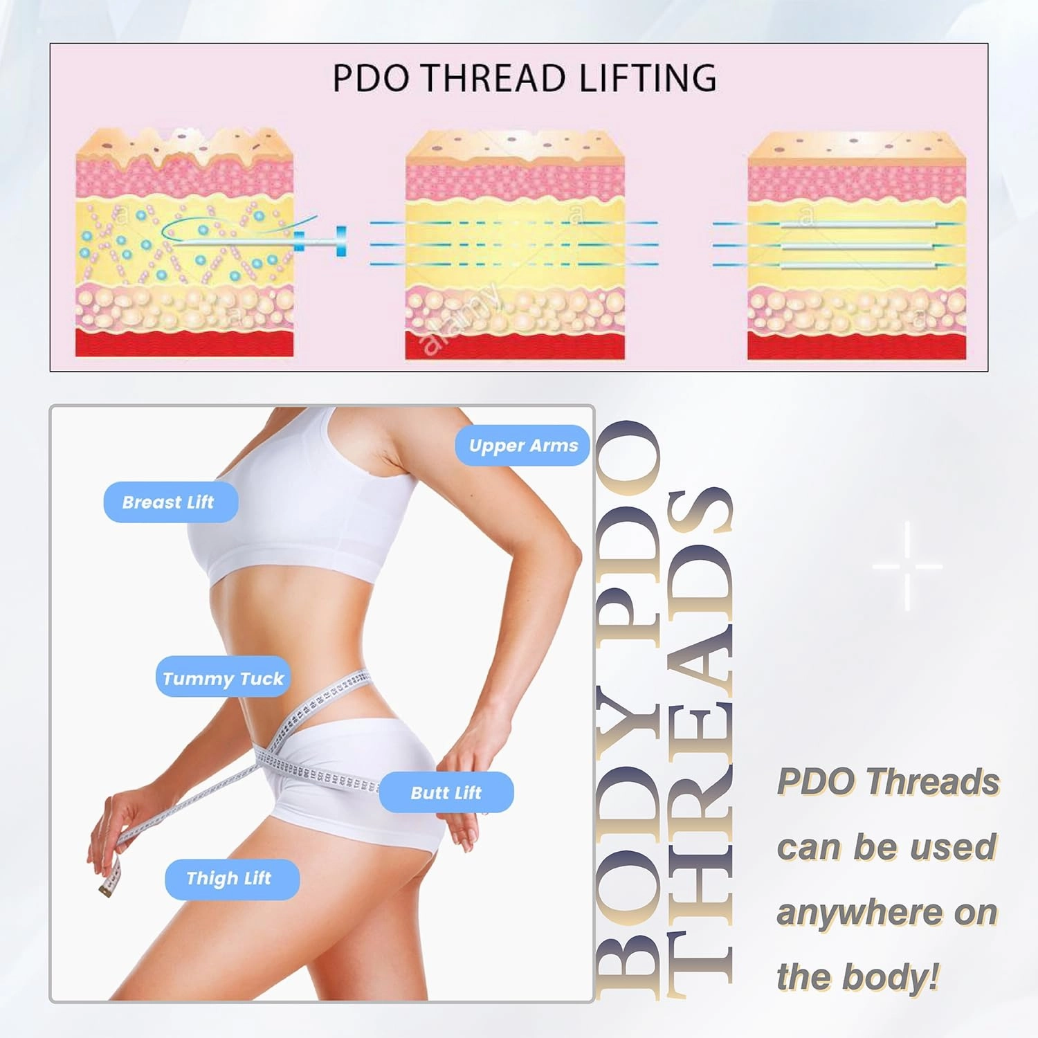 Pdo Threads for Face Lift Mono Screw Type (30g38MM) Smoothing Wrinkles PDO Thread Lift for Whole Body with Sharp Tip 20pcs